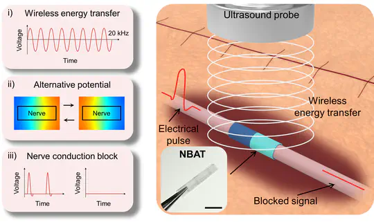 Monolithic bioresorbable pain blocker with acoustically switchable triboelectric field
